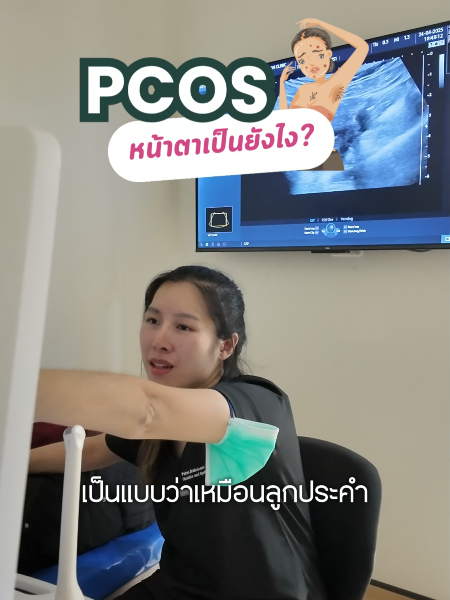 PCOS อาการที่ควรมาตรวจ
