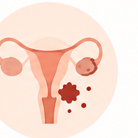 Endometriosis